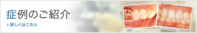 症例のご紹介 詳しくはこちら